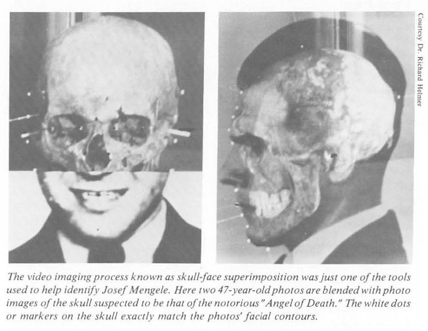 Sobreposição craniofacial, uma das ferramentas usadas para identificar Josef Mengele.